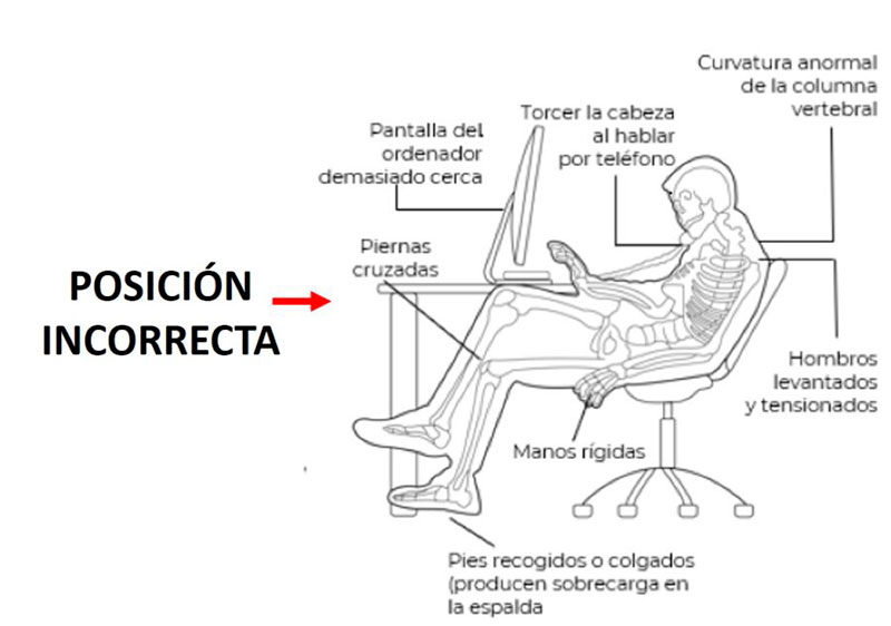 NOM Teletrabajo posición incorrecta