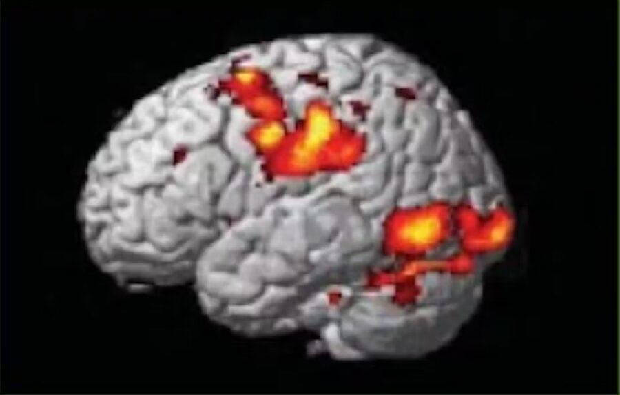 Imagen cerebral cuando el individuo se siente seguro / Imagen: Fourni par l'auteur