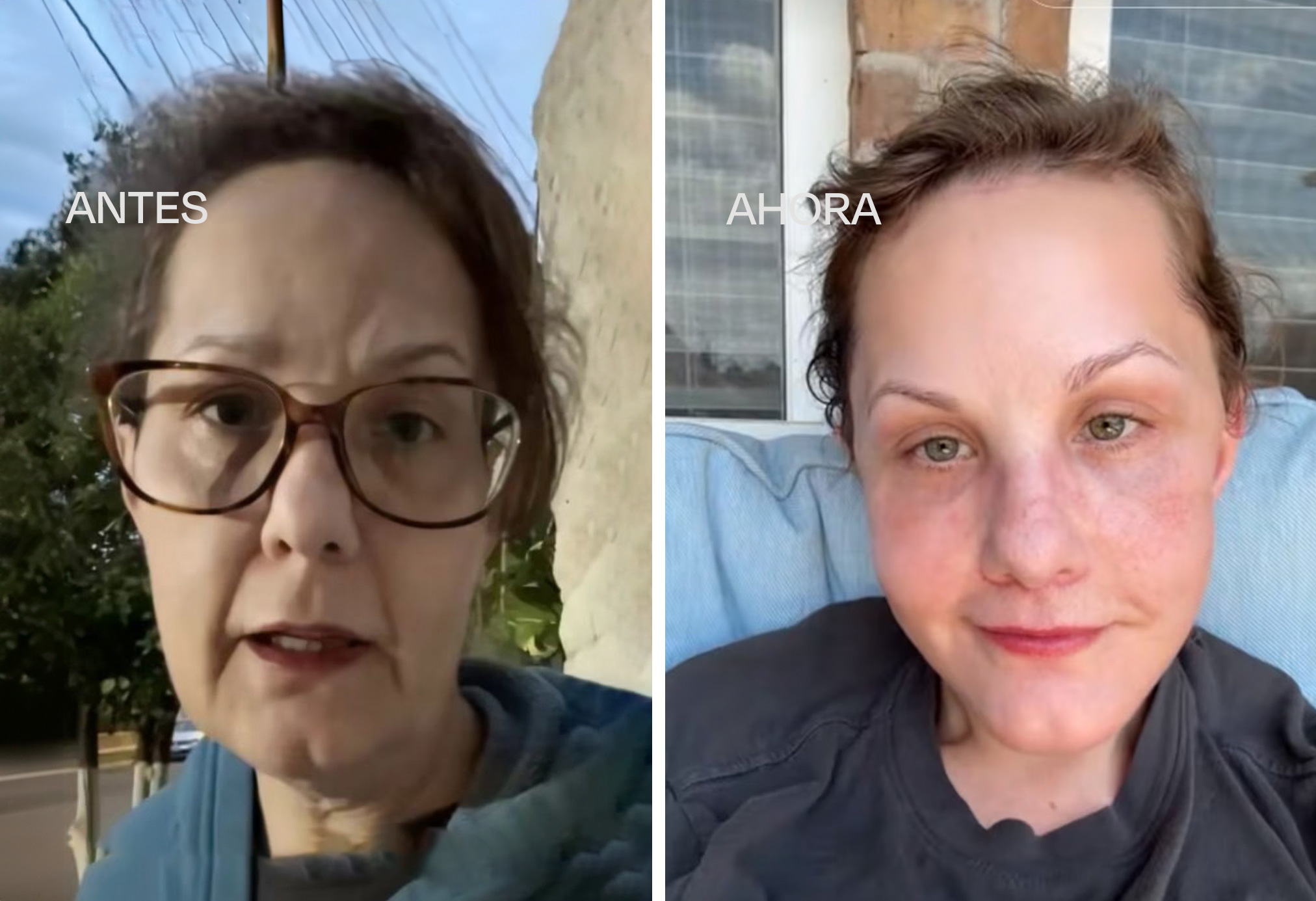 Guadalajara Facelift