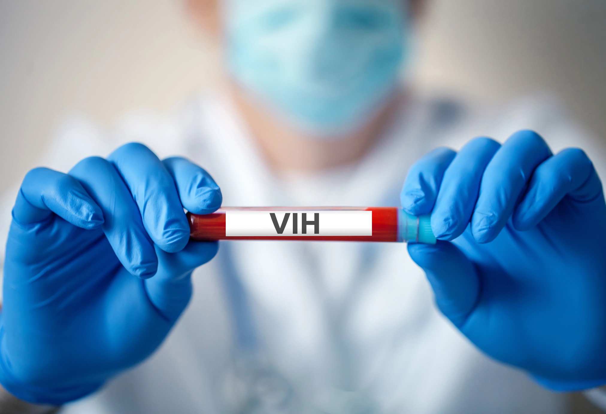 VIH y esperanza de vida: claves del tratamiento moderno