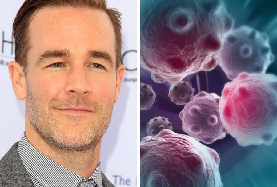 James Van Der Beek y el foco en el cáncer colorrectal: la tendencia en jóvenes | Imagen: Depositphotos.com