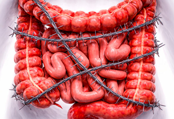 4 síntomas de cáncer de colon que no debes ignorar (aunque seas joven)