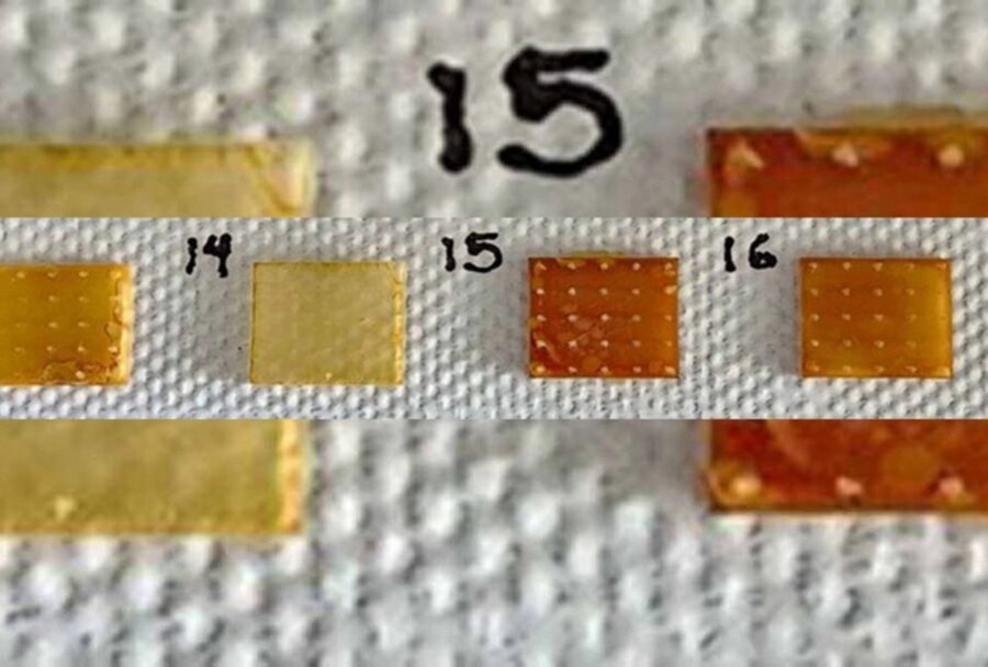 UNAM crea parche con microagujas y maíz que podría controlar la hipertensión sin pastillas