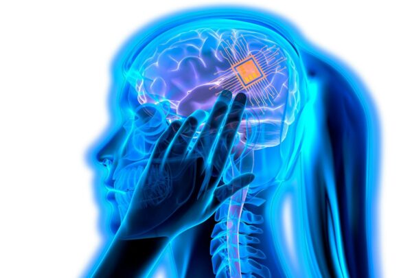 China aprueba NEO, un implante cerebral que ayudó a un hombre a volver a escribir