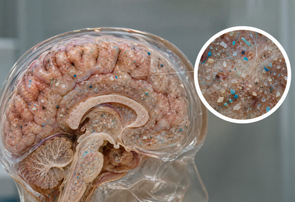 ¿De verdad tenemos una ‘cucharada de microplásticos’ en el cerebro? Esto encontró el estudio