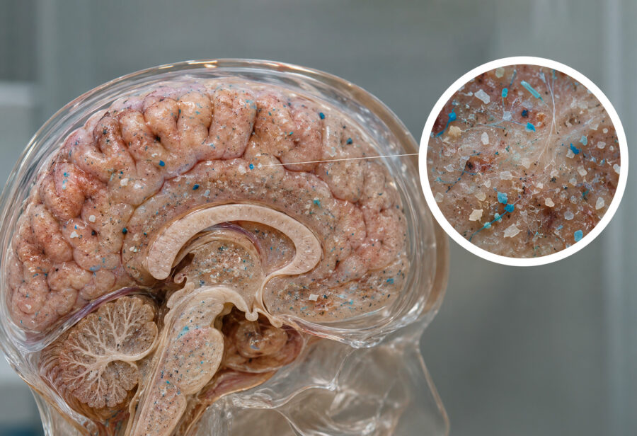 ¿De verdad tenemos una ‘cucharada de microplásticos’ en el cerebro? Esto encontró el estudio